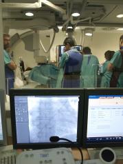 Imagen de la intervención realizada corregir una el denominado foramen oval permeable