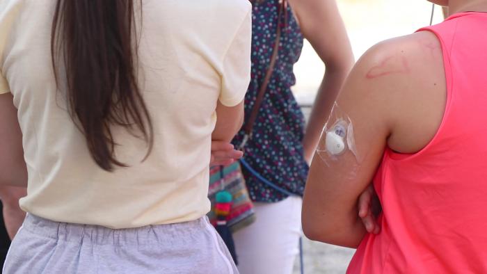 El servicio de Endocrinología de Ciudad Real elabora recomendaciones para pacientes con diabetes mellitus que presenten síntomas de covid19