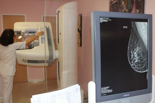 La Comisión Europea concede la designación de ‘buena práctica’ al programa de cribado de cáncer de mama del Gobierno de Castilla-La Mancha en Toledo