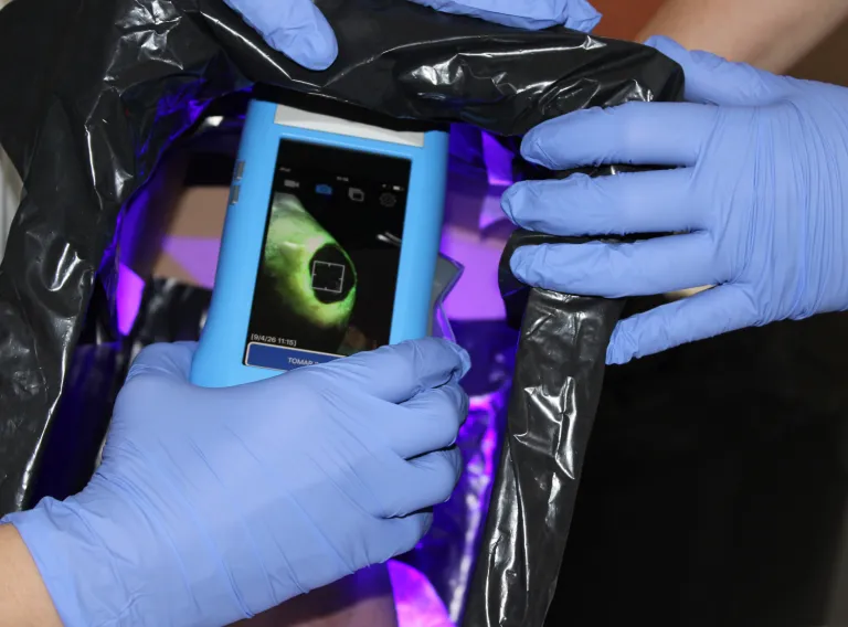 La Gerencia de Alcázar de San Juan refuerza la atención a pacientes con heridas complejas con nueva tecnología de diagnóstico